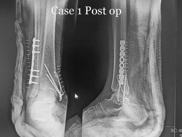 Rahul Jagtap|Nerul,Navi Mumbai